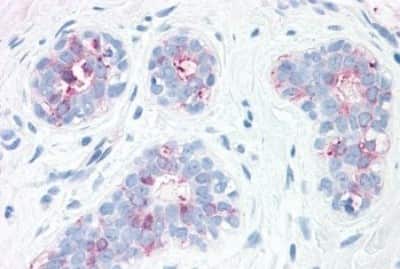 Immunohistochemistry-Paraffin: Synaptogyrin 2 Antibody [NBP3-14490]